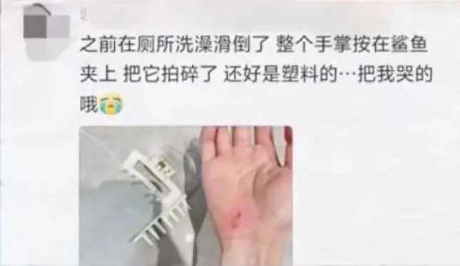 戴鲨鱼夹摔倒昏迷女子回家康复，家的温暖唤醒记忆深处的故事