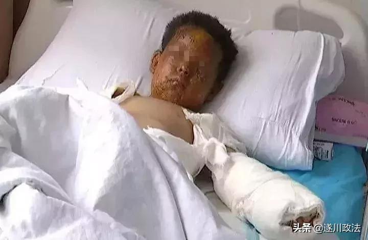 厨房液化气泄漏爆燃母子受伤背后的励志故事，挑战与人生的转变之路