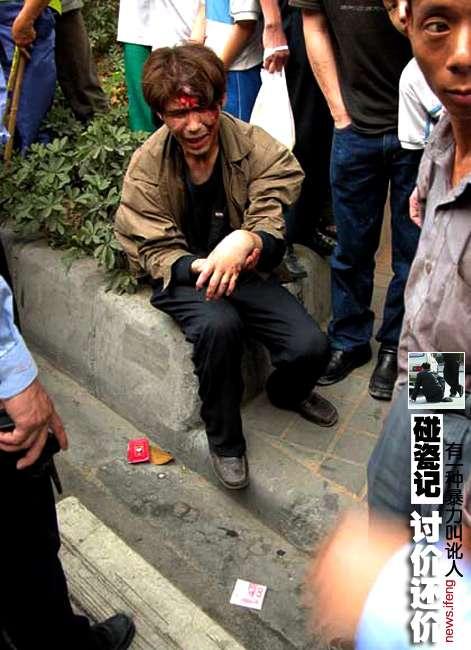 老人撞人欲逃离，女子阻拦遭咬，事件引发社会道德与个人责任深思
