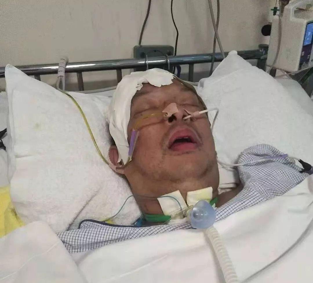 百万粉丝网红因脑溢血昏迷离世，警醒生命脆弱的残酷现实💔