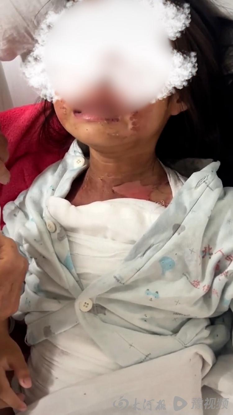 女童遭高年级男生泼水烫伤事件，校方的回应与成长中的力量
