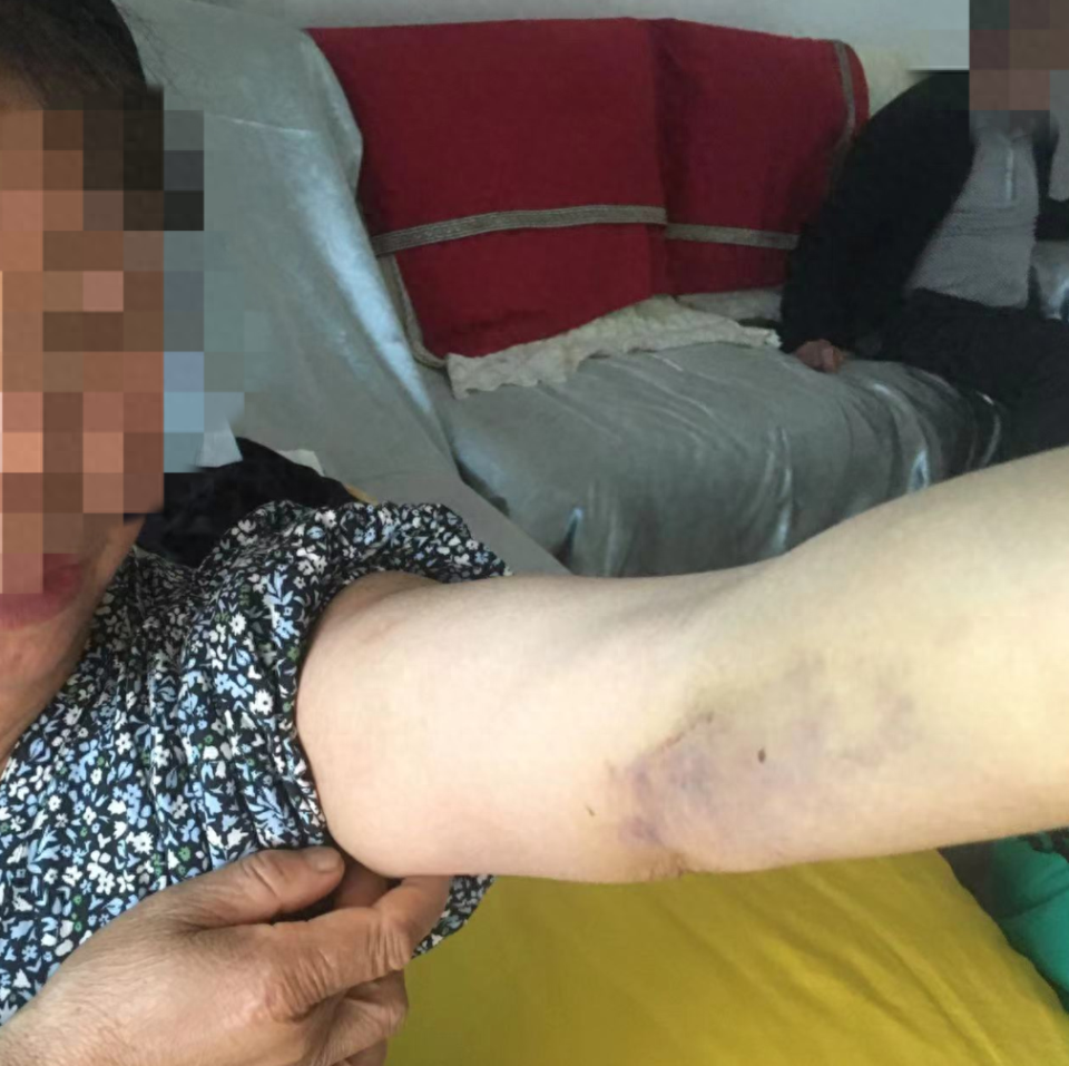 警方回应女子被误认赌徒遭打断肋骨事件，严肃处理，维护公正正义！